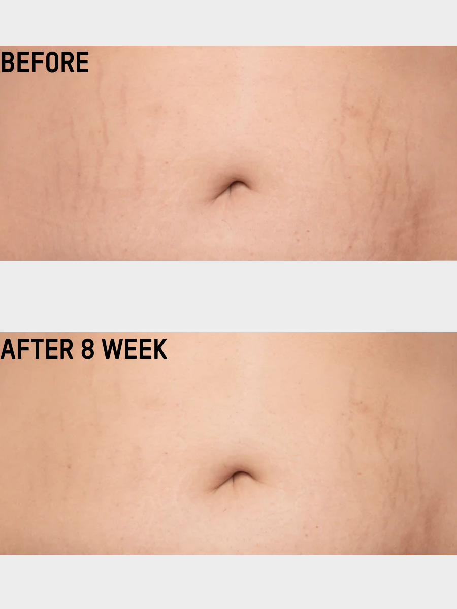 Smooth & Tighten Belly Cream