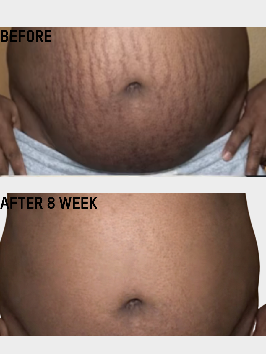 Smooth & Tighten Belly Cream
