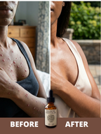 Balancing Essential Oil-(SKIN)