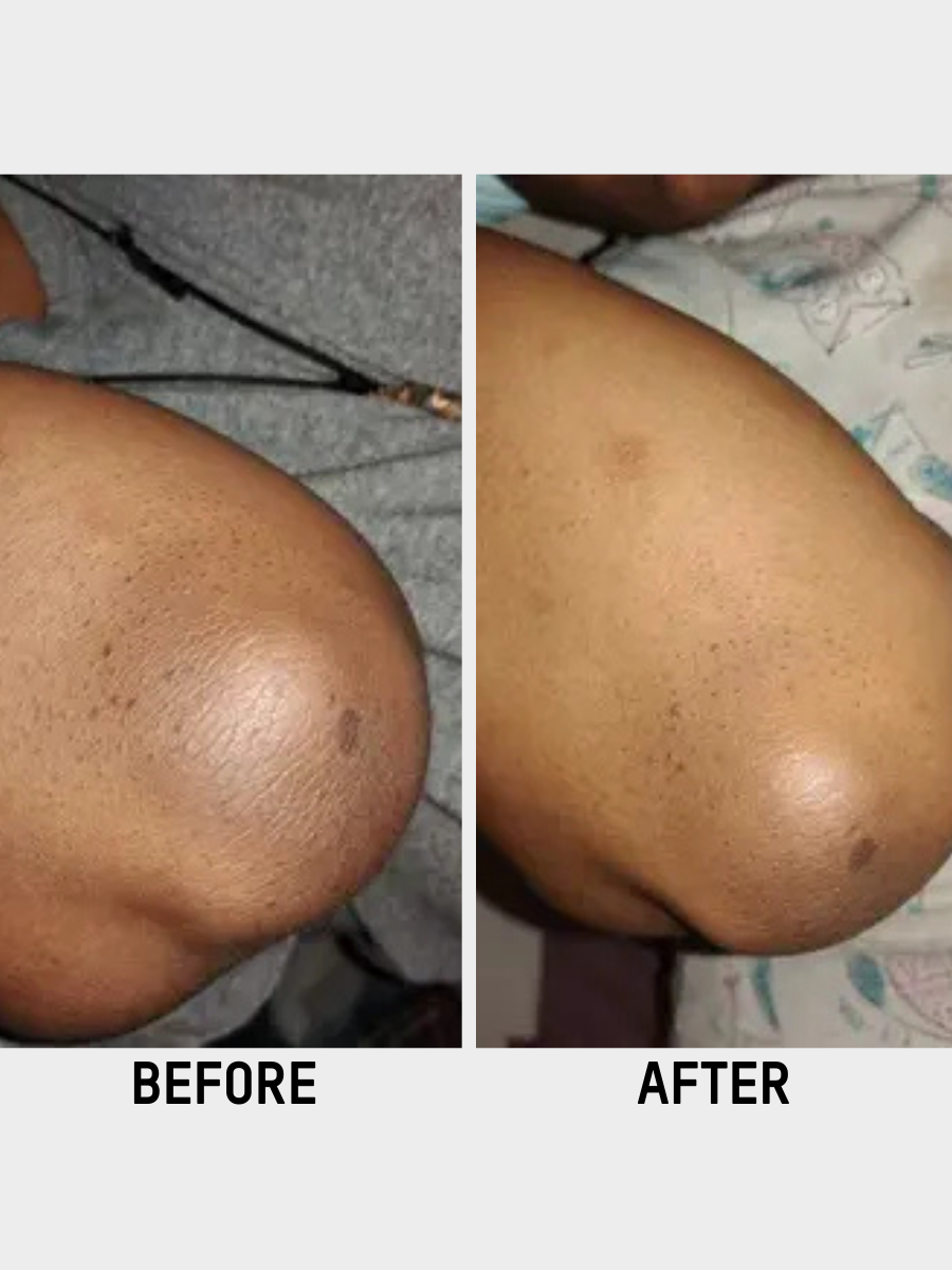 Even Tone Serum