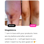 Inner Thighs Lightening Cream