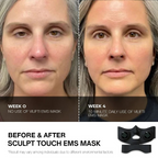 Face-Lifting EMS Mask
