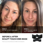 Face-Lifting EMS Mask