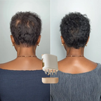 Laser Scalp Therapy Comb