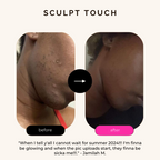 Turmeric Dark Spot Assasin Scrub