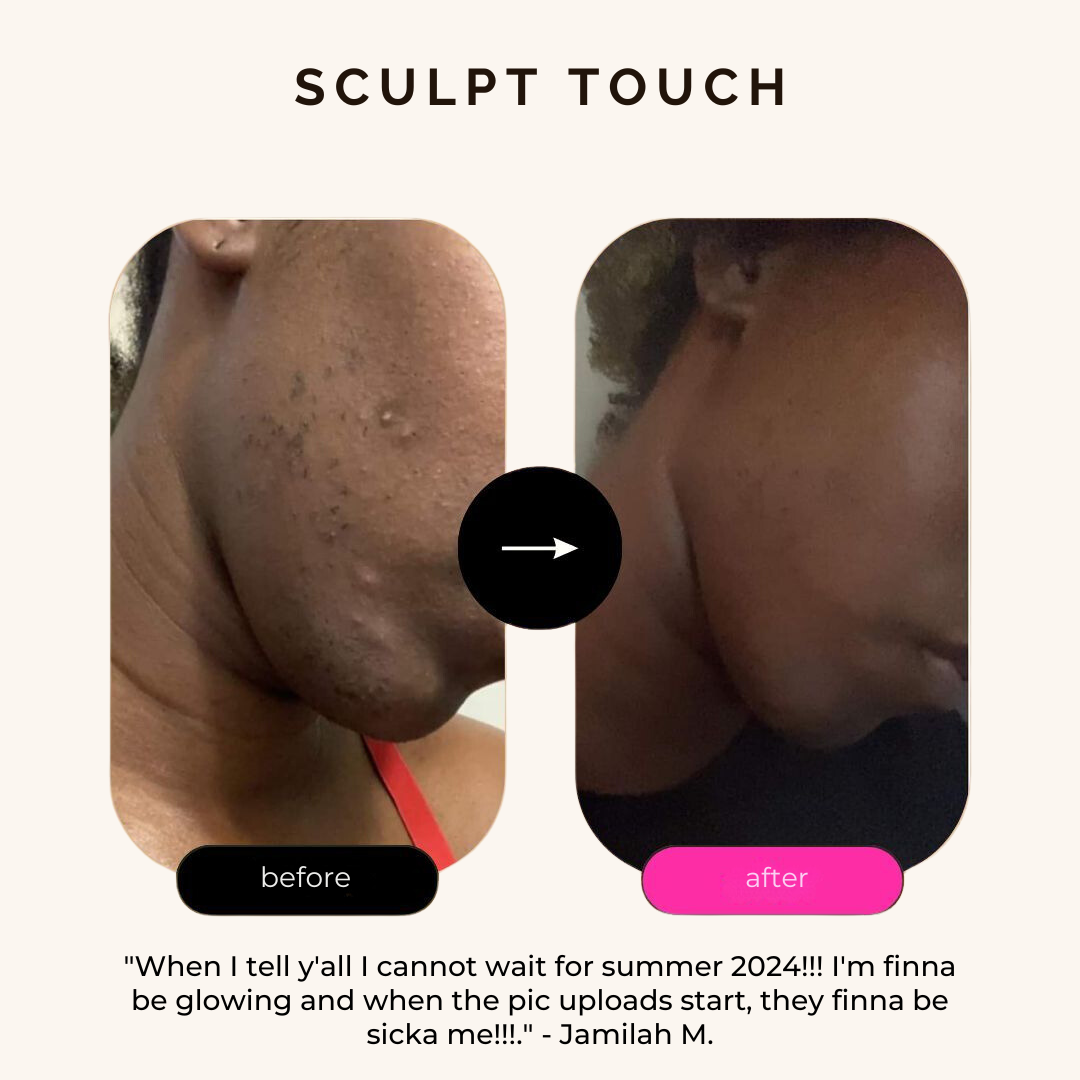 Turmeric Dark Spot Assasin Scrub
